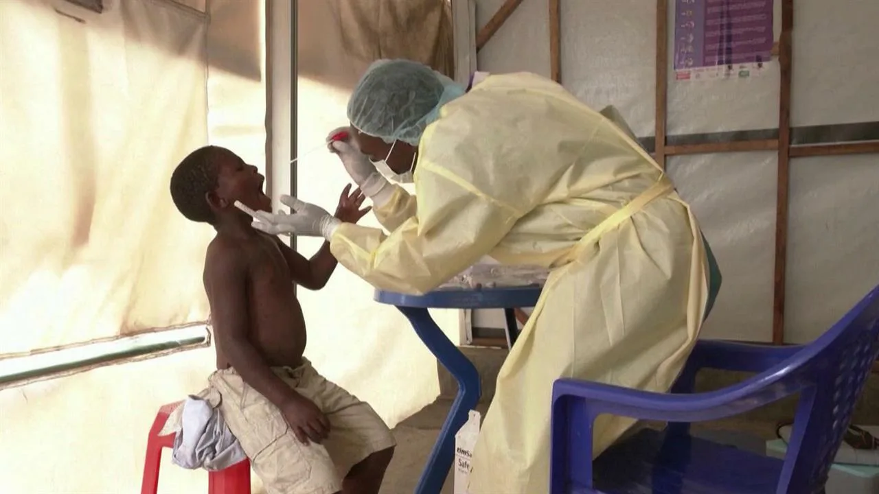 Senegal Confirms First Mpox Case of 2025 Amid Regional Outbreak Concerns