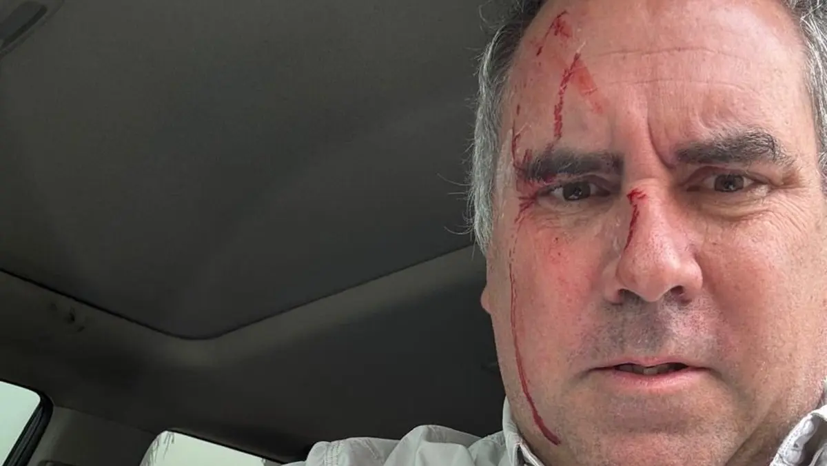 Peruvian Presidential Candidate Survives Shooting Attack in Lima