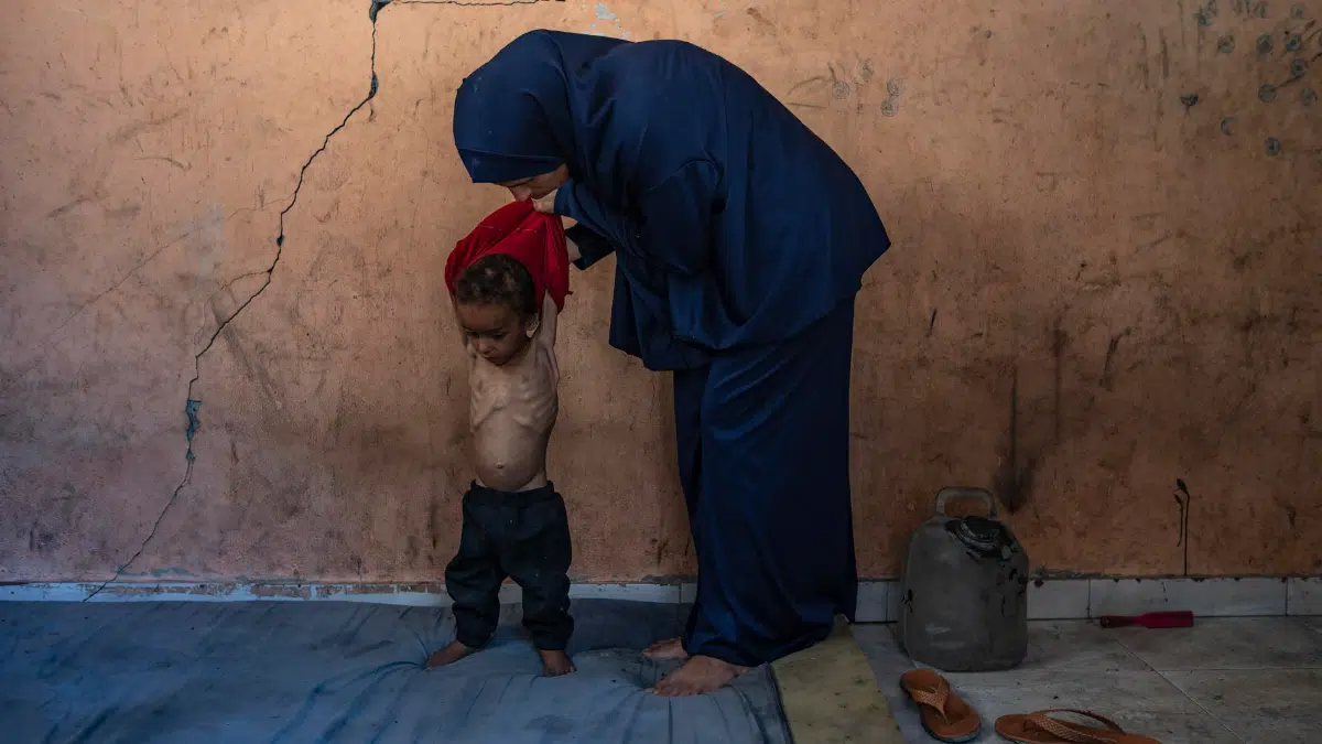 (FILE) The organization warned that 90% of babies born to malnourished mothers were premature and 84% were underweight at birth. Photo: EFE.