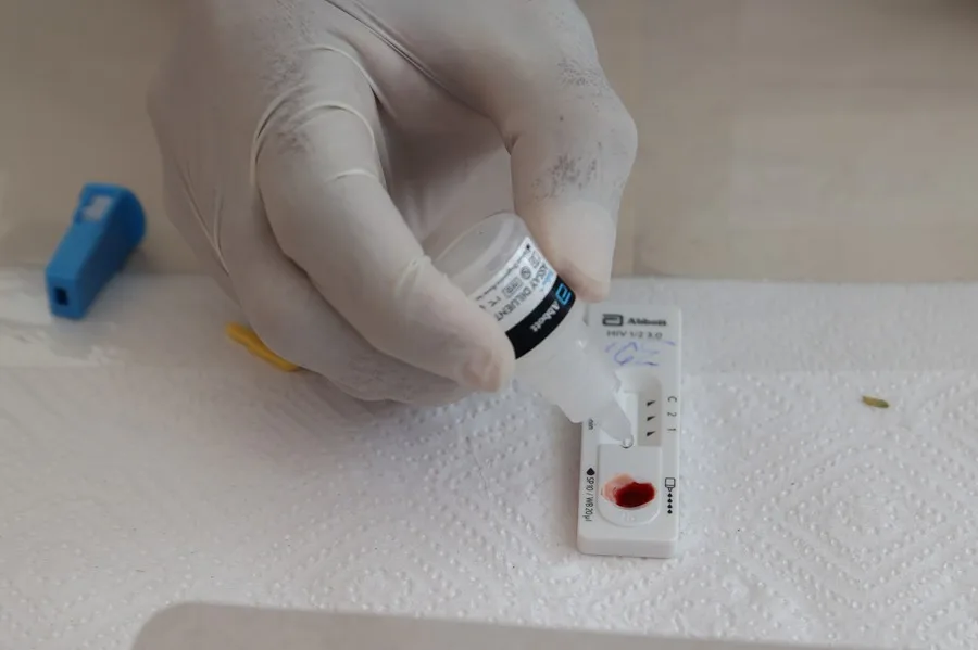 The government will strengthen available care by increasing access to diagnostics, therapies and pre-exposure prophylaxis (PrEP). Photo: EFE.